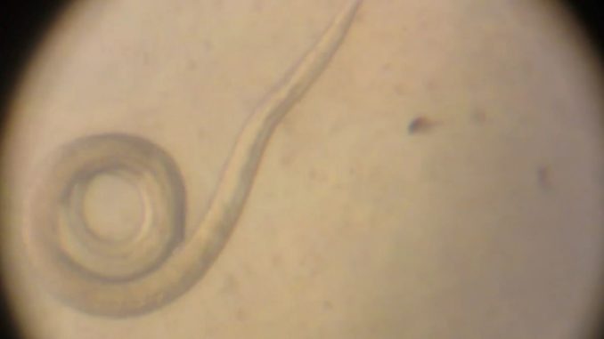trihineloza